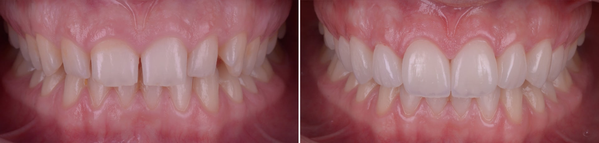clinica dentara timisoara stomatologie clinica rugina