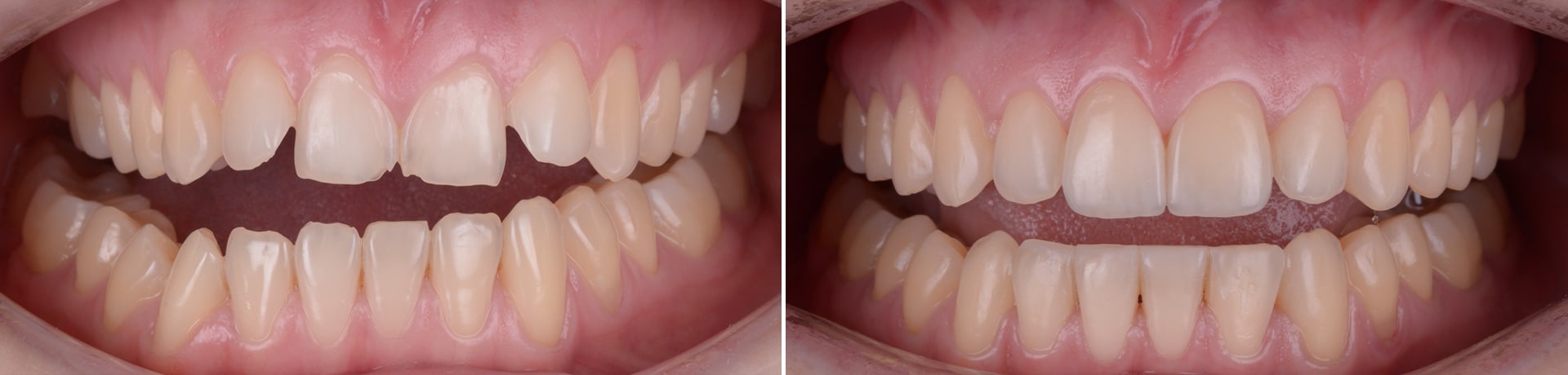 plan tratament daniela zambet natural clinica dentara timisoara clinica rugina