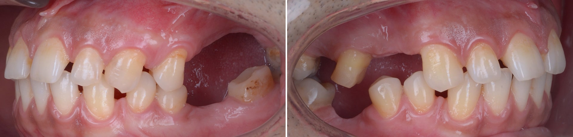 zambet functional clinica dentara timisoara cabinet stomatologie rugina